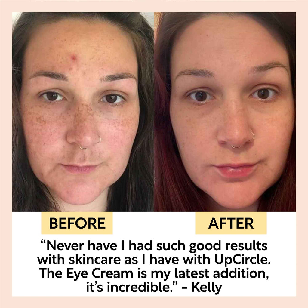 "Hyaluronic acid eye cream with coffee by UpCircle, glass jar product view"