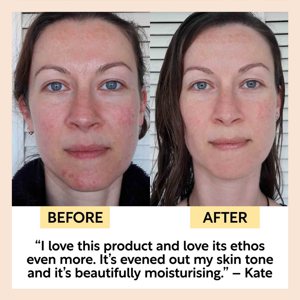 anti-aging skincare bundle