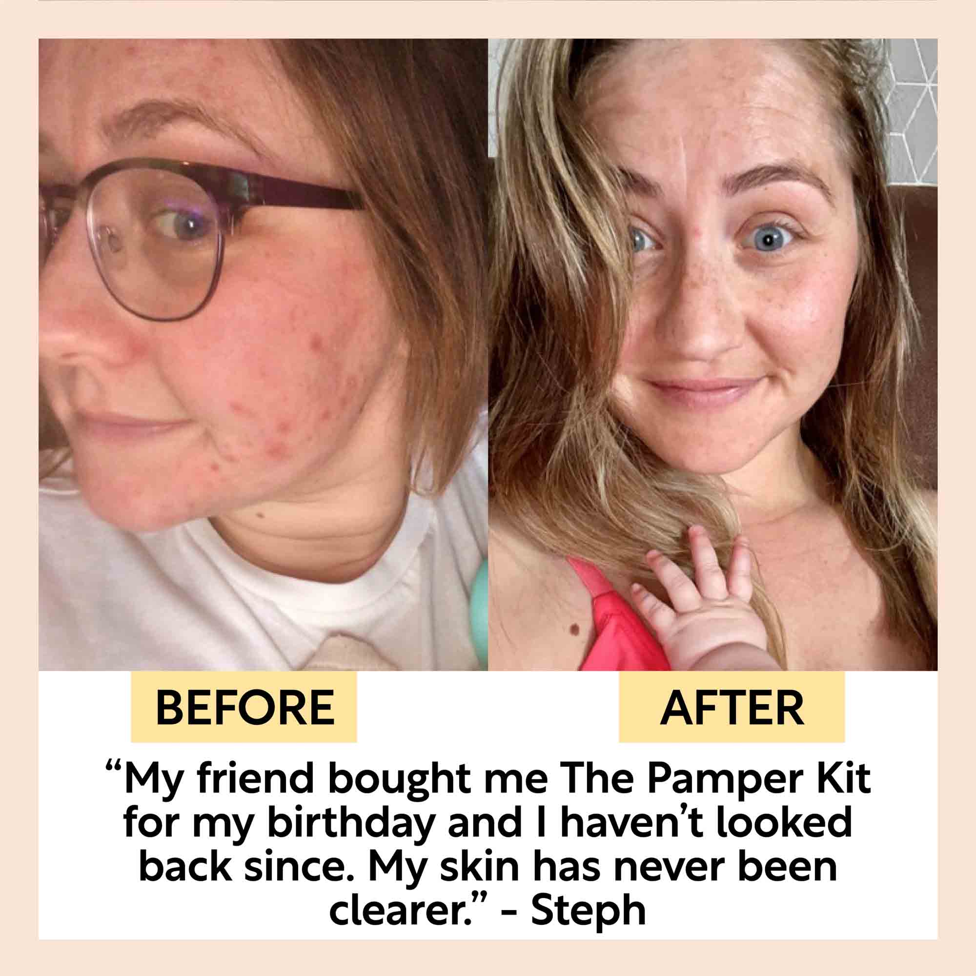 skincare sample kit