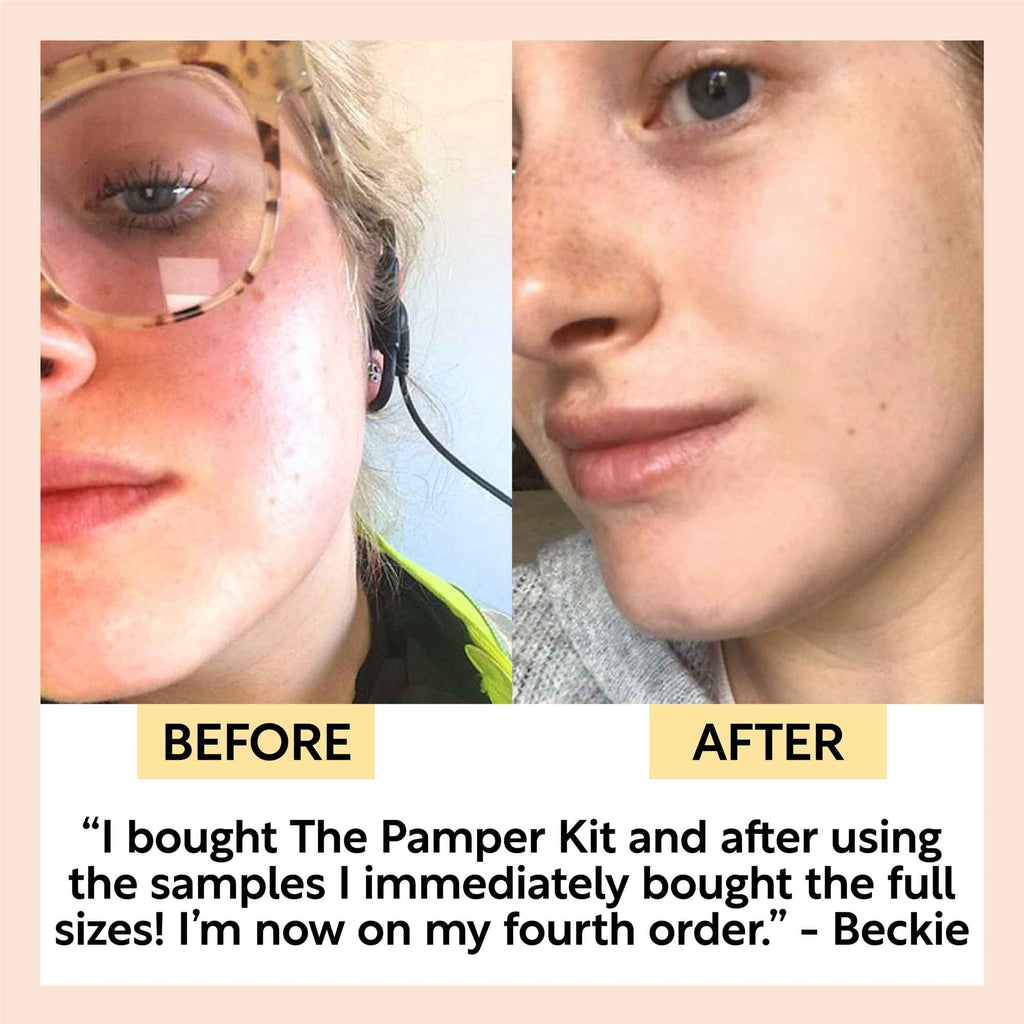 skincare sample kit